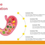 Gastritis Plantilla PowerPoint