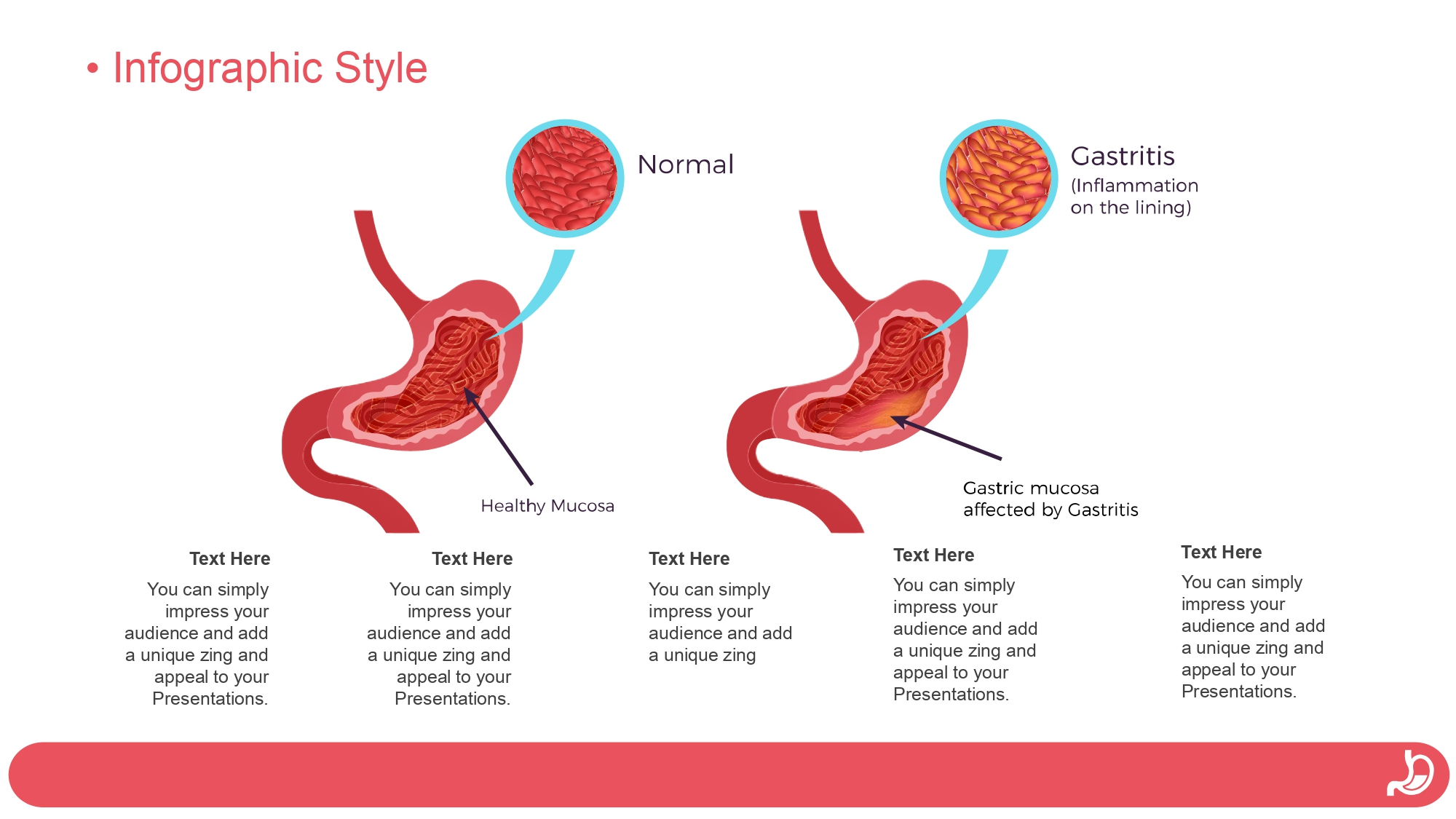 Gastritis Plantilla PowerPoint