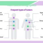 Tuberculosis Plantilla PowerPoint