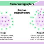 Tuberculosis Plantilla PowerPoint