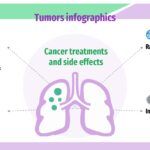 Tuberculosis Plantilla PowerPoint
