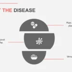 Plantillas PowerPoint de Cáncer Cerebral