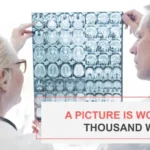 Plantillas PowerPoint de Cáncer Cerebral