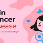 Plantillas PowerPoint de Cáncer de Piel