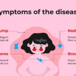 Plantillas PowerPoint de Cáncer de Piel